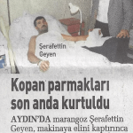 Uzuv Kopmaları Tedavisi