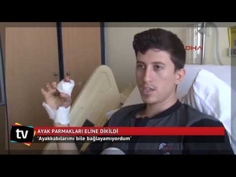Ayak parmakları eline dikildi